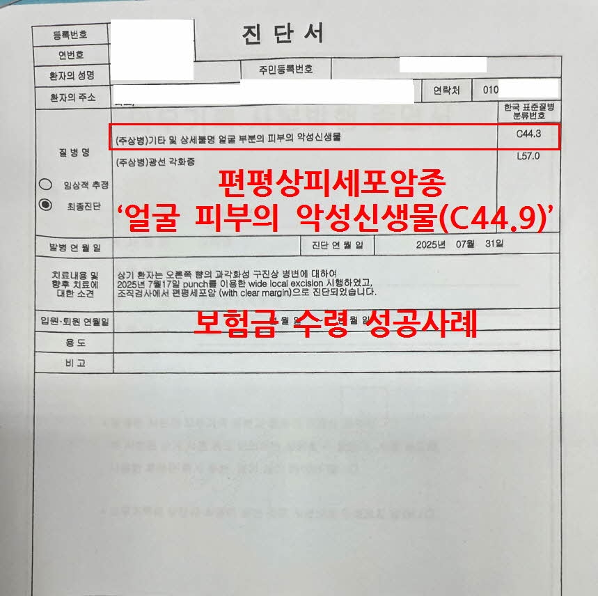 편평상피세포암종  ‘얼굴 피부의 악성신생물(C44.9)’ 보험금 수령 성공사례