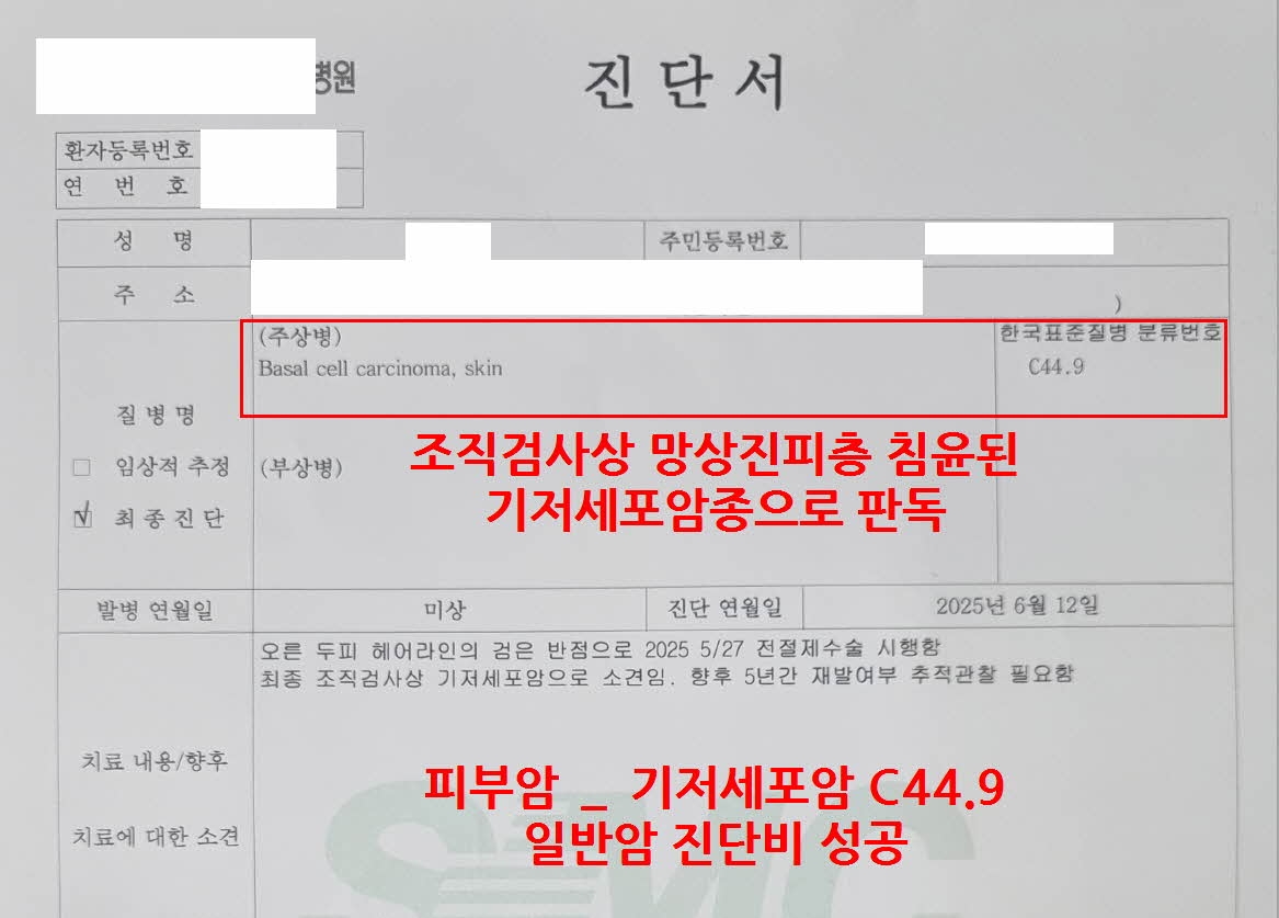 피부암 진단비 기저세포암 진단비 일반암진단비 수령 성공